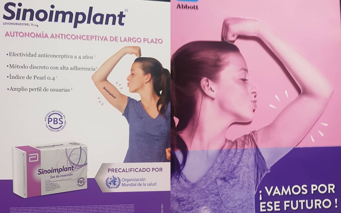 implante